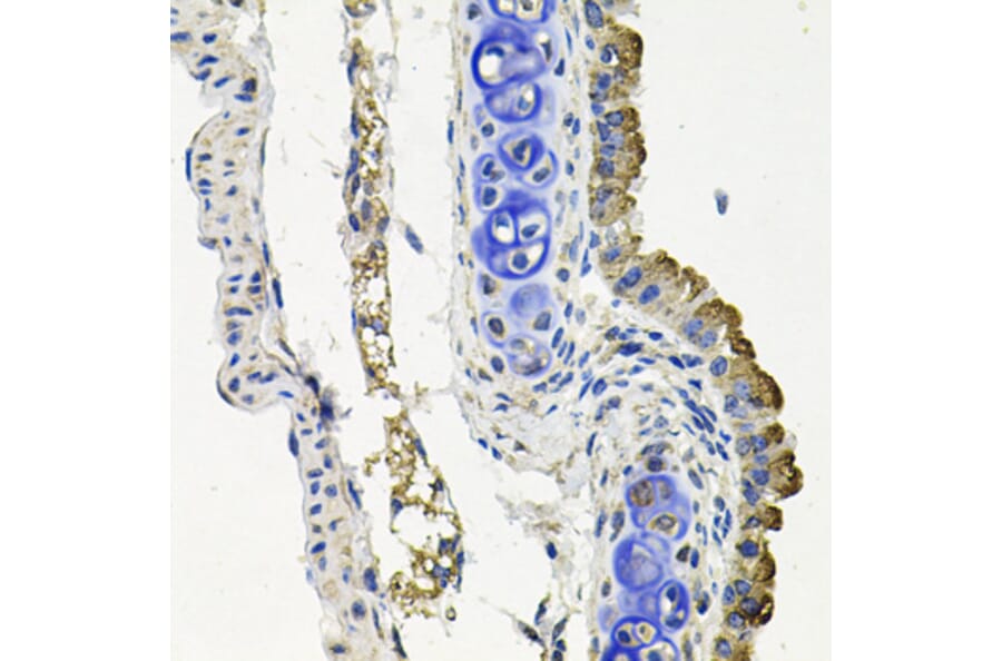 Immunohistochemistry - Anti-MARK1 Antibody (A12254) - Antibodies.com