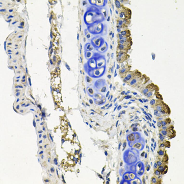 Immunohistochemistry - Anti-MARK1 Antibody (A12254) - Antibodies.com