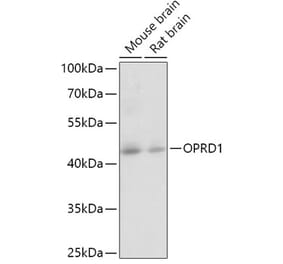 Western Blot - Anti-Delta Opioid Receptor Antibody (A12255) - Antibodies.com