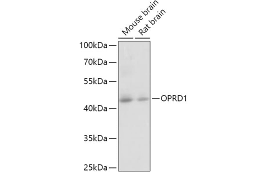 Western Blot - Anti-Delta Opioid Receptor Antibody (A12255) - Antibodies.com