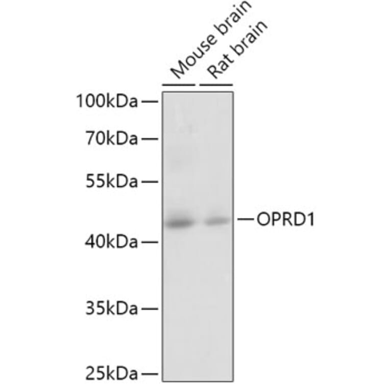 Western Blot - Anti-Delta Opioid Receptor Antibody (A12255) - Antibodies.com
