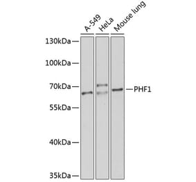 Western Blot - Anti-PHF1 Antibody (A12257) - Antibodies.com