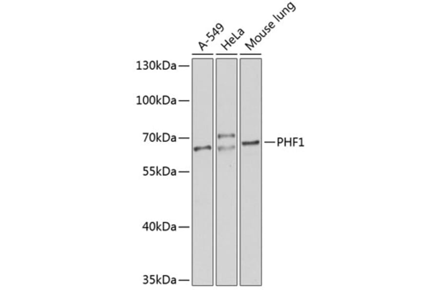 Western Blot - Anti-PHF1 Antibody (A12257) - Antibodies.com