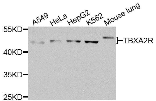 Western blot analysis of extracts of various cell lines, using Anti-TBXA2R Antibody (A8458) at 1:1,000 dilution.
Secondary antibody: Goat Anti-Rabbit IgG (H+L) (HRP) (AS014) at 1:10,000 dilution.
Lysates / proteins: 25µg per lane.
Blocking buffer: 3% non-fat dry milk in TBST.
Detection: ECL Basic Kit (RM00020).
Exposure time: 60s.