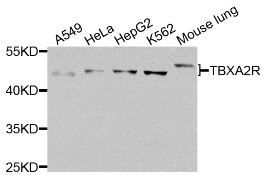Western Blot - Anti-TBXA2R Antibody (A8458) - Antibodies.com