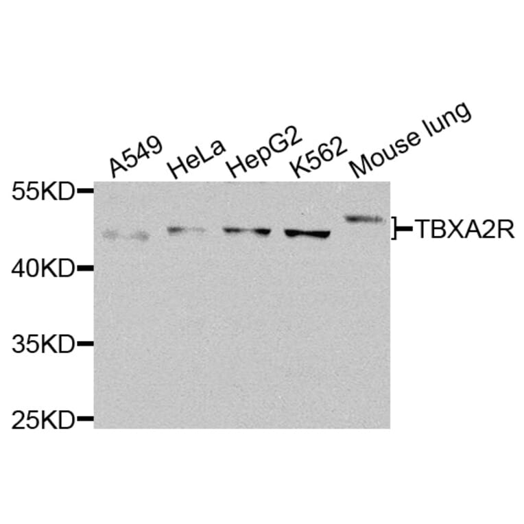 Western Blot - Anti-TBXA2R Antibody (A8458) - Antibodies.com