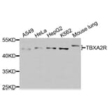 Western Blot - Anti-TBXA2R Antibody (A8458) - Antibodies.com