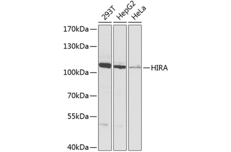 Western Blot - Anti-HIRA/HIR Antibody (A12259) - Antibodies.com