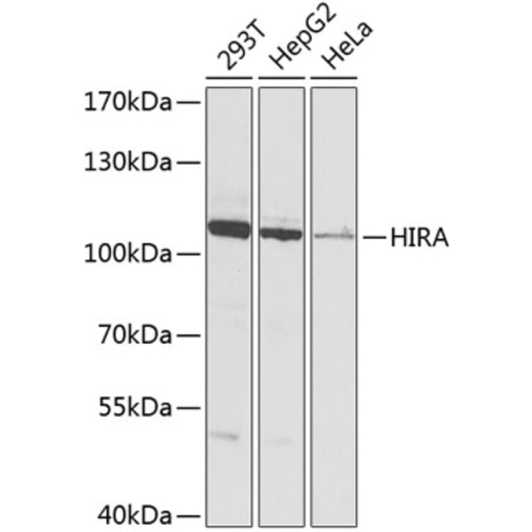 Western Blot - Anti-HIRA/HIR Antibody (A12259) - Antibodies.com