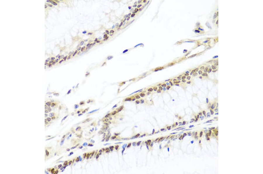 Immunohistochemistry - Anti-HIRA/HIR Antibody (A12259) - Antibodies.com