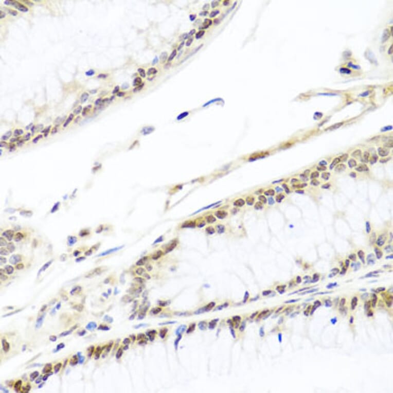 Immunohistochemistry - Anti-HIRA/HIR Antibody (A12259) - Antibodies.com
