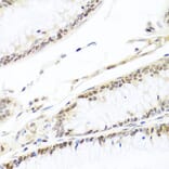 Immunohistochemistry - Anti-HIRA/HIR Antibody (A12259) - Antibodies.com