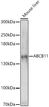 Western blot analysis of extracts of various cell lines, using Anti-ABCB11 Antibody (A8467) at 1:1,000 dilution. Secondary antibody: Goat Anti-Rabbit IgG (H+L) (HRP) (AS014) at 1:10,000 dilution. Lysates / proteins: 25µg per lane. Blocking buffer: 3% non-fat dry milk in TBST. Detection: ECL Enhanced Kit (RM00021). Exposure time: 60s.