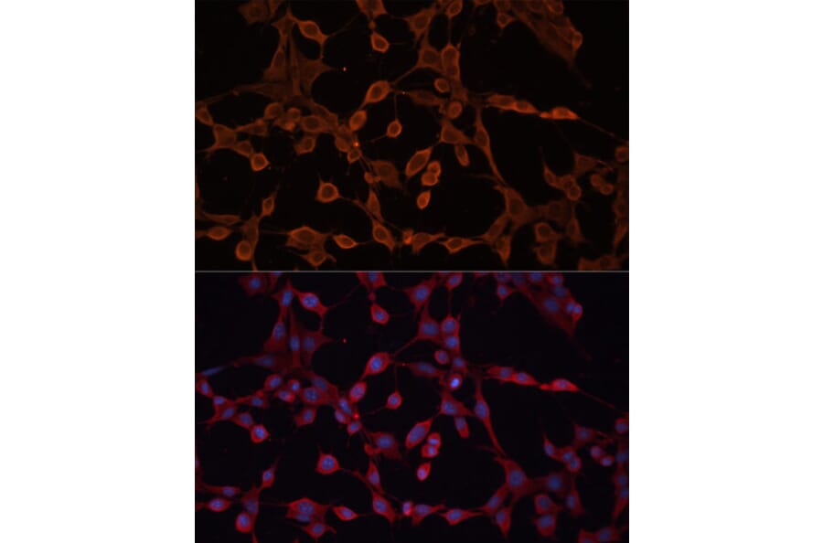 Immunofluorescence - Anti-ABCB11/BSEP Antibody (A12260) - Antibodies.com