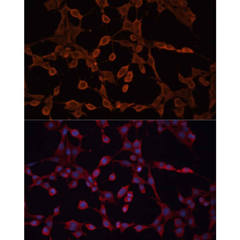 Immunofluorescence - Anti-ABCB11/BSEP Antibody (A12260) - Antibodies.com