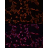 Immunofluorescence - Anti-ABCB11/BSEP Antibody (A12260) - Antibodies.com