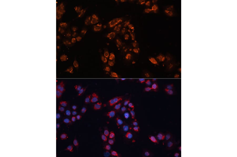 Immunofluorescence - Anti-ABCB11/BSEP Antibody (A12260) - Antibodies.com