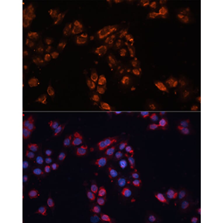 Immunofluorescence - Anti-ABCB11/BSEP Antibody (A12260) - Antibodies.com