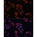 Immunofluorescence - Anti-ABCB11/BSEP Antibody (A12260) - Antibodies.com