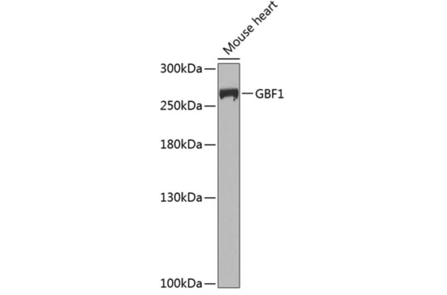 Western Blot - Anti-GBF1 Antibody (A12261) - Antibodies.com