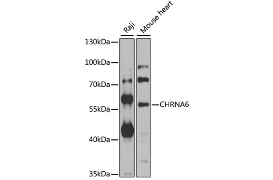Western Blot - Anti-CHRNA6 Antibody (A8470) - Antibodies.com