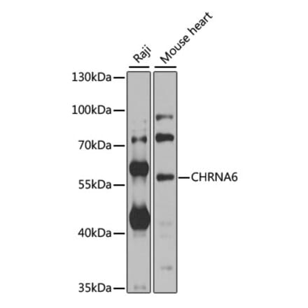 Western Blot - Anti-CHRNA6 Antibody (A8470) - Antibodies.com