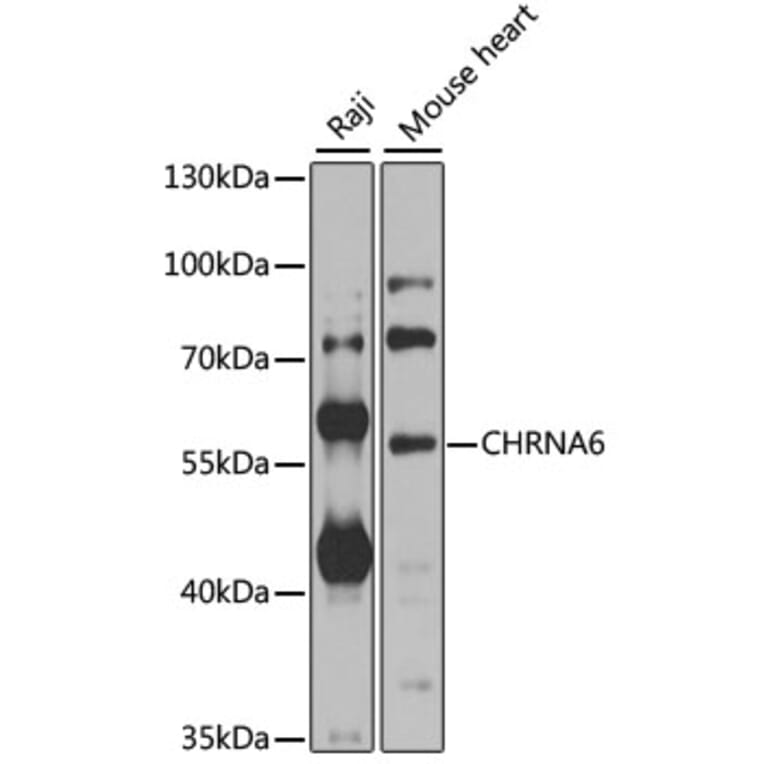 Western Blot - Anti-CHRNA6 Antibody (A8470) - Antibodies.com