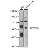 Western Blot - Anti-CHRNA6 Antibody (A8470) - Antibodies.com