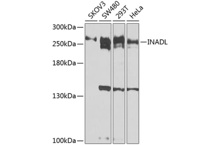 Western Blot - Anti-PATJ Antibody (A12263) - Antibodies.com