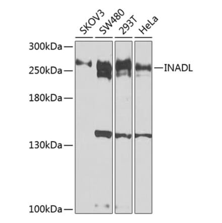 Western Blot - Anti-PATJ Antibody (A12263) - Antibodies.com