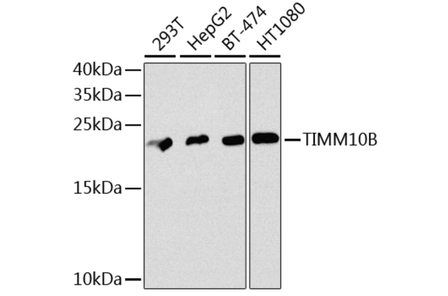Western Blot - Anti-TIMM10B Antibody (A12264) - Antibodies.com