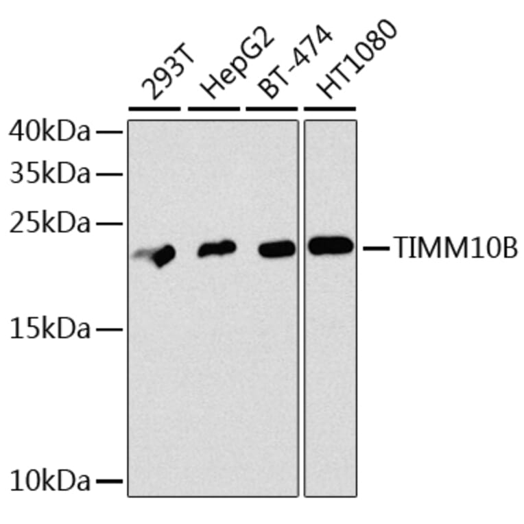 Western Blot - Anti-TIMM10B Antibody (A12264) - Antibodies.com