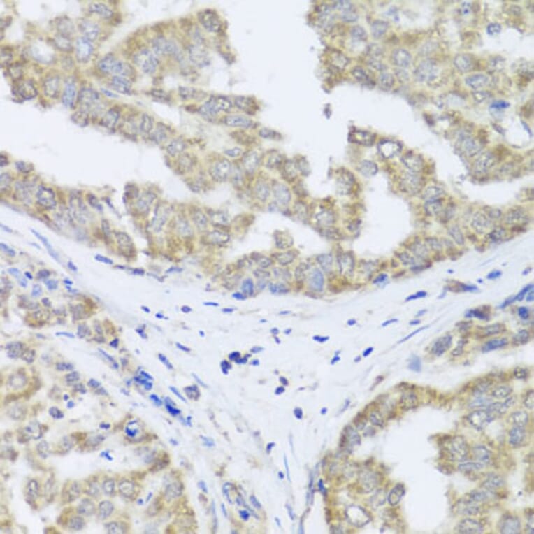 Immunohistochemistry - Anti-TIMM10B Antibody (A12264) - Antibodies.com