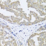 Immunohistochemistry - Anti-TIMM10B Antibody (A12264) - Antibodies.com