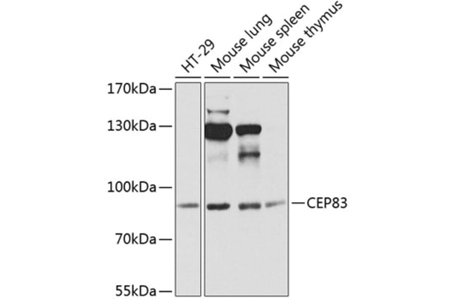 Western Blot - Anti-CEP83 Antibody (A12265) - Antibodies.com
