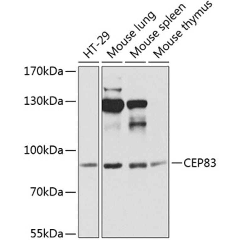 Western Blot - Anti-CEP83 Antibody (A12265) - Antibodies.com