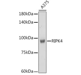 Western Blot - Anti-RIPK4 Antibody (A12266) - Antibodies.com