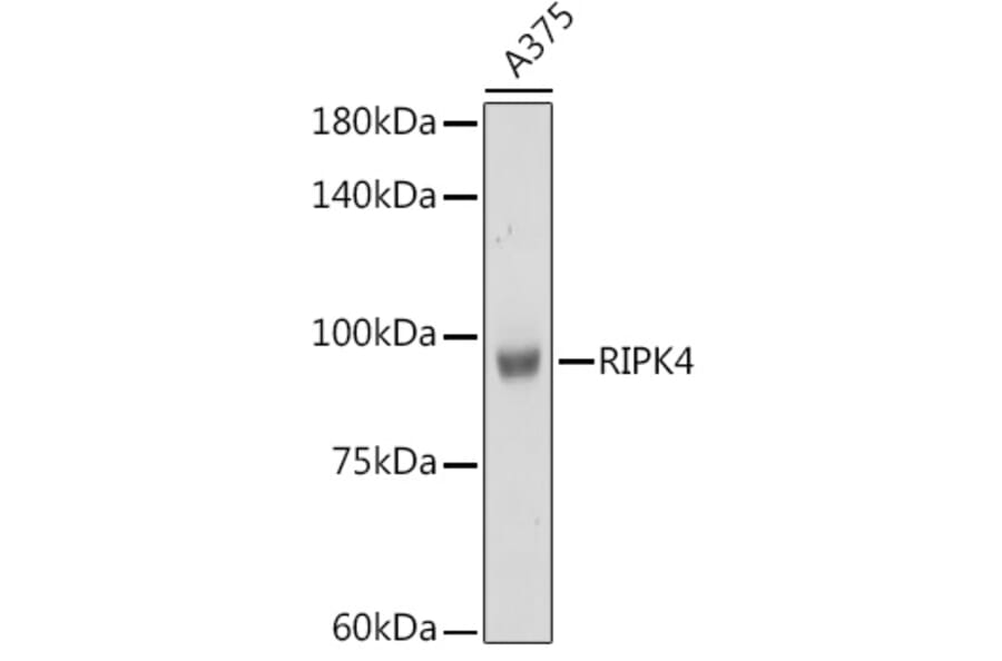 Western Blot - Anti-RIPK4 Antibody (A12266) - Antibodies.com