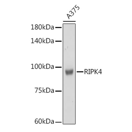 Western Blot - Anti-RIPK4 Antibody (A12266) - Antibodies.com