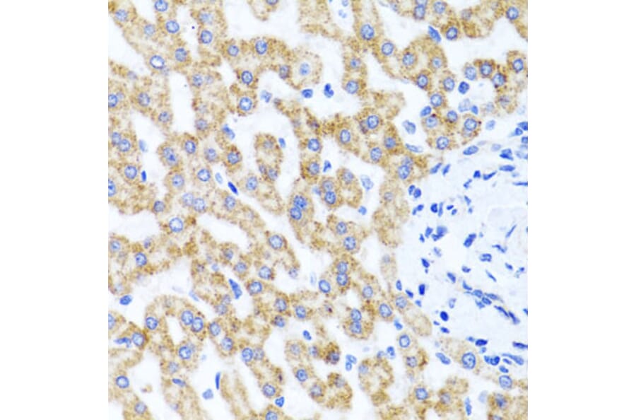 Immunohistochemistry - Anti-RIPK4 Antibody (A12266) - Antibodies.com