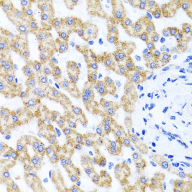 Immunohistochemistry - Anti-RIPK4 Antibody (A12266) - Antibodies.com