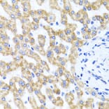 Immunohistochemistry - Anti-RIPK4 Antibody (A12266) - Antibodies.com