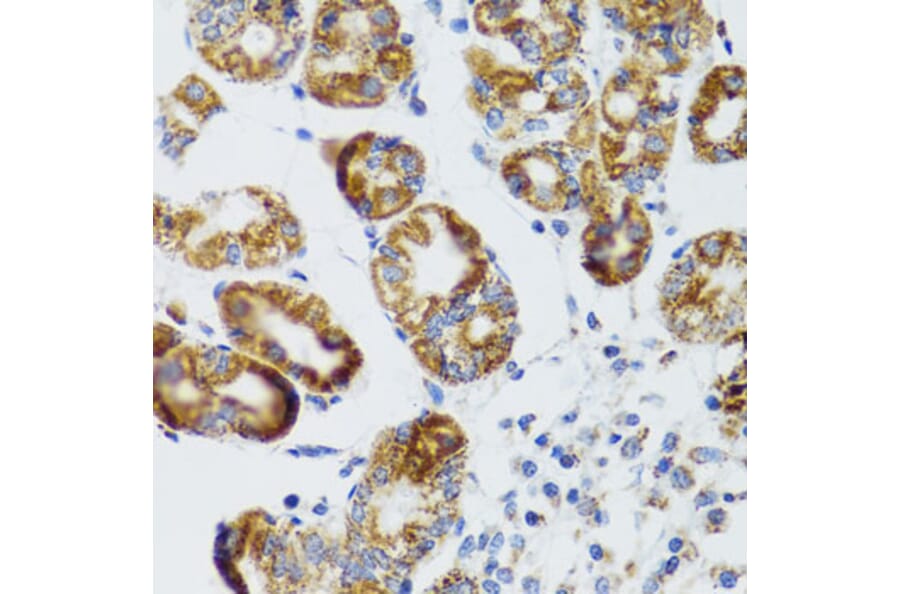 Immunohistochemistry - Anti-RIPK4 Antibody (A12266) - Antibodies.com