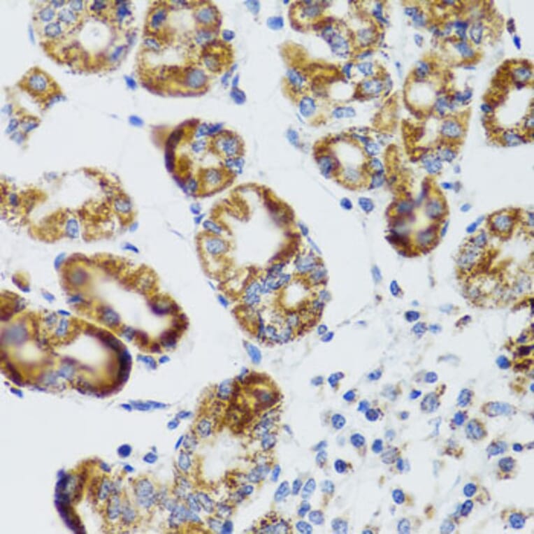 Immunohistochemistry - Anti-RIPK4 Antibody (A12266) - Antibodies.com