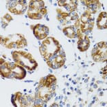 Immunohistochemistry - Anti-RIPK4 Antibody (A12266) - Antibodies.com