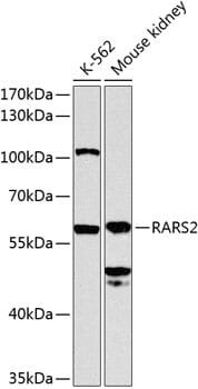 Western blot analysis of extracts of various cell lines, using Anti-RARS2 Antibody (A8503) at 1:1,000 dilution. Secondary antibody: Goat Anti-Rabbit IgG (H+L) (HRP) (AS014) at 1:10,000 dilution. Lysates / proteins: 25µg per lane. Blocking buffer: 3% non-fat dry milk in TBST. Detection: ECL Enhanced Kit (RM00021). Exposure time: 90s.