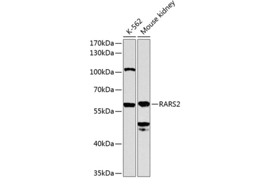 Western Blot - Anti-RARS2 Antibody (A12268) - Antibodies.com
