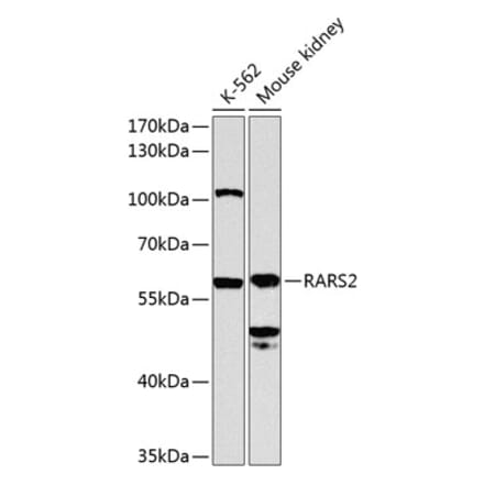 Western Blot - Anti-RARS2 Antibody (A12268) - Antibodies.com