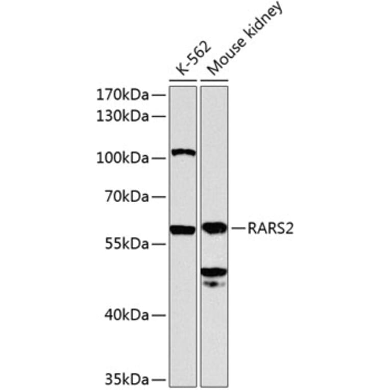 Western Blot - Anti-RARS2 Antibody (A12268) - Antibodies.com