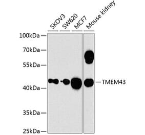 Western Blot - Anti-TMEM43 Antibody (A12271) - Antibodies.com